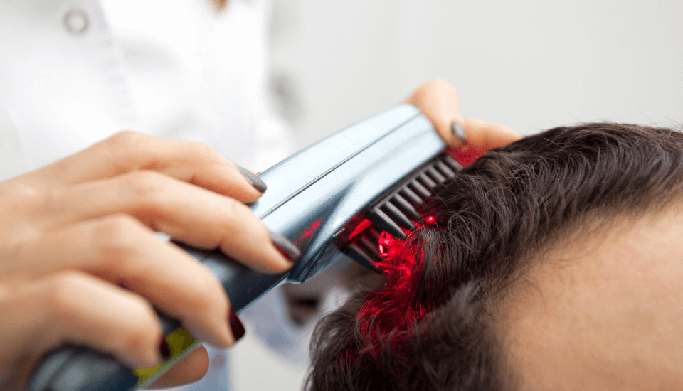 terapia a laser para queda de cabelo